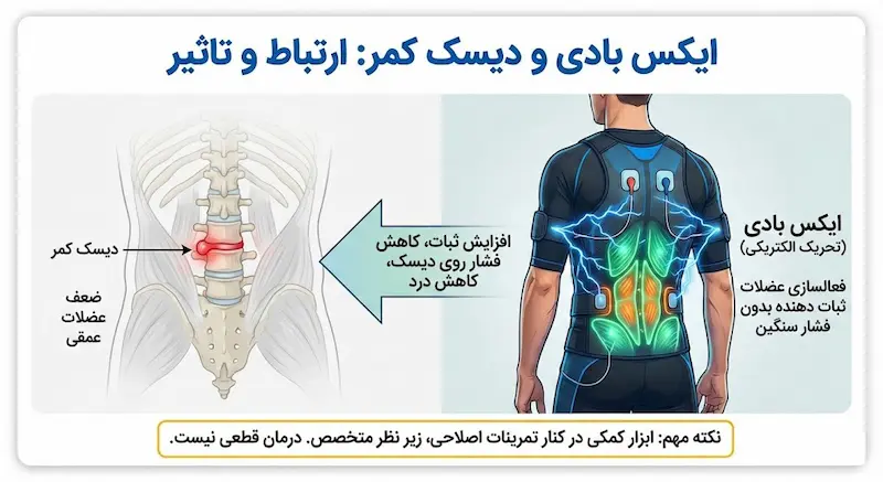 ایکس بادی چه ارتباطی با دیسک کمر دارد؟