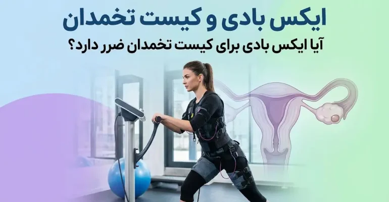 ایکس بادی و کیست تخمدان - آیا ایکس بادی برای کیست تخمدان ضرر دارد؟